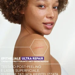 A-Derma Epitheliale - Ultra Repair Crema Ristrutturante Anti-Segni Riparazione Cutanea Lesioni Post-Peeling e Laser con Acido Ialuronico, 40ml