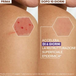 A-Derma Epitheliale - Ultra Repair Crema Ristrutturante Anti-Segni Riparazione Cutanea Lesioni Post-Peeling e Laser con Acido Ialuronico, 40ml