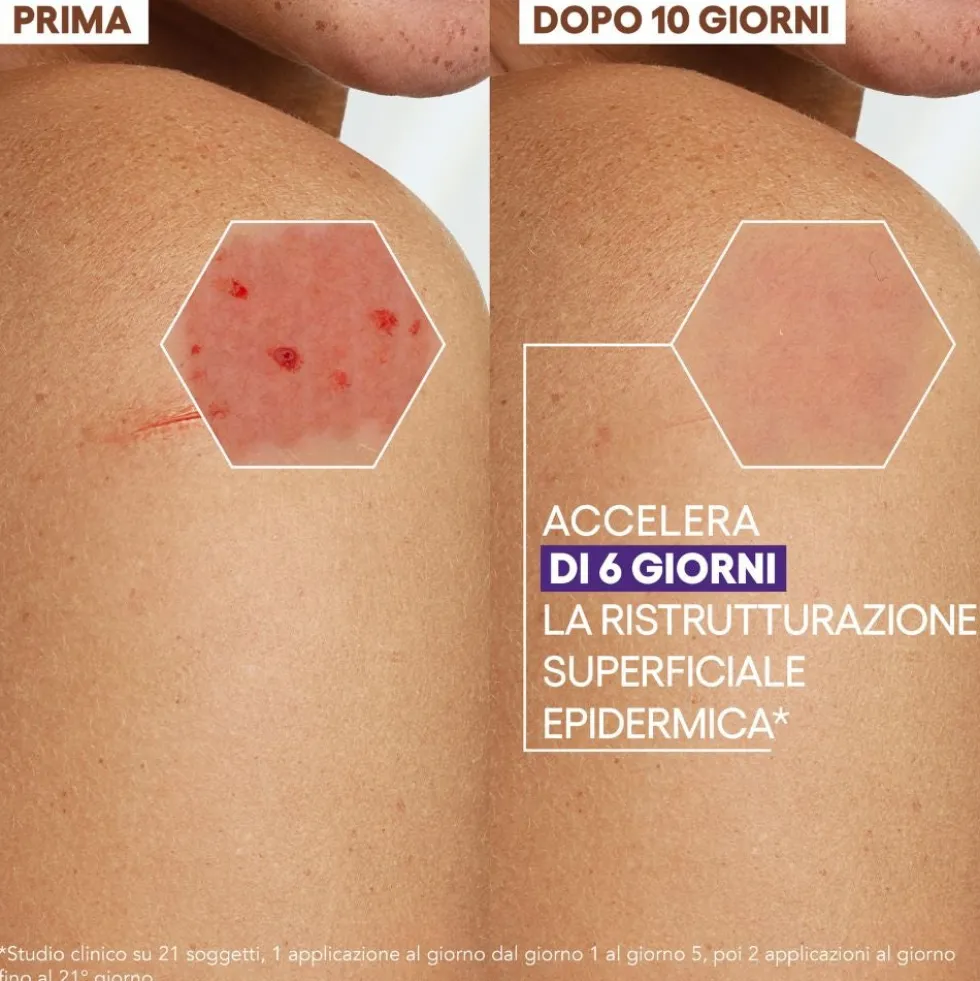 A-Derma Epitheliale - Ultra Repair Crema Ristrutturante Anti-Segni Riparazione Cutanea Lesioni Post-Peeling e Laser con Acido Ialuronico, 40ml