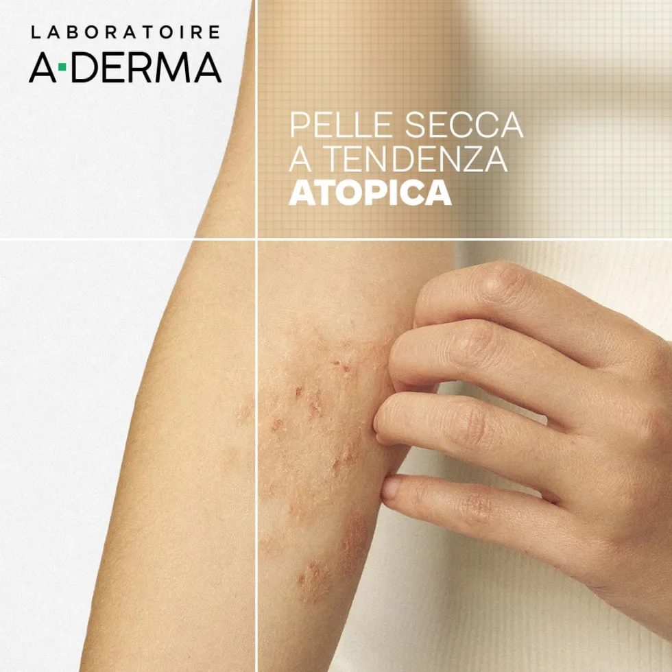A-Derma Exomega Control - Olio Lavante Emolliente Anti-grattage per Pelle Secca a Tendenza Atopica Prurito, 200ml