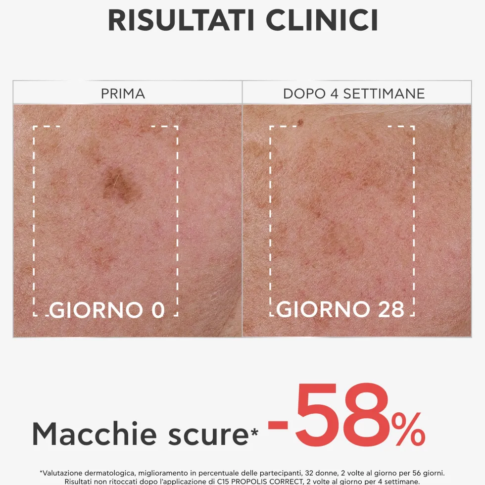Apivita C15 Propolis Correct - Siero viso alla vitamina C contro le rughe e le macchie, 30 ml