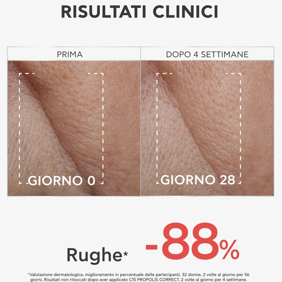 Apivita C15 Propolis Correct - Siero viso alla vitamina C contro le rughe e le macchie, 30 ml
