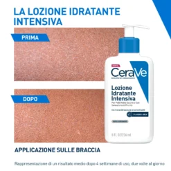 CeraVe Lozione Idratante Intensiva per Pelle Secca e Molto Secca con Prurito Idrata e Dona Sollievo, 236ml