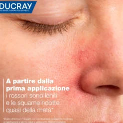 Ducray Kelual DS - Crema Lenitiva Anti-Squame Viso, 40ml