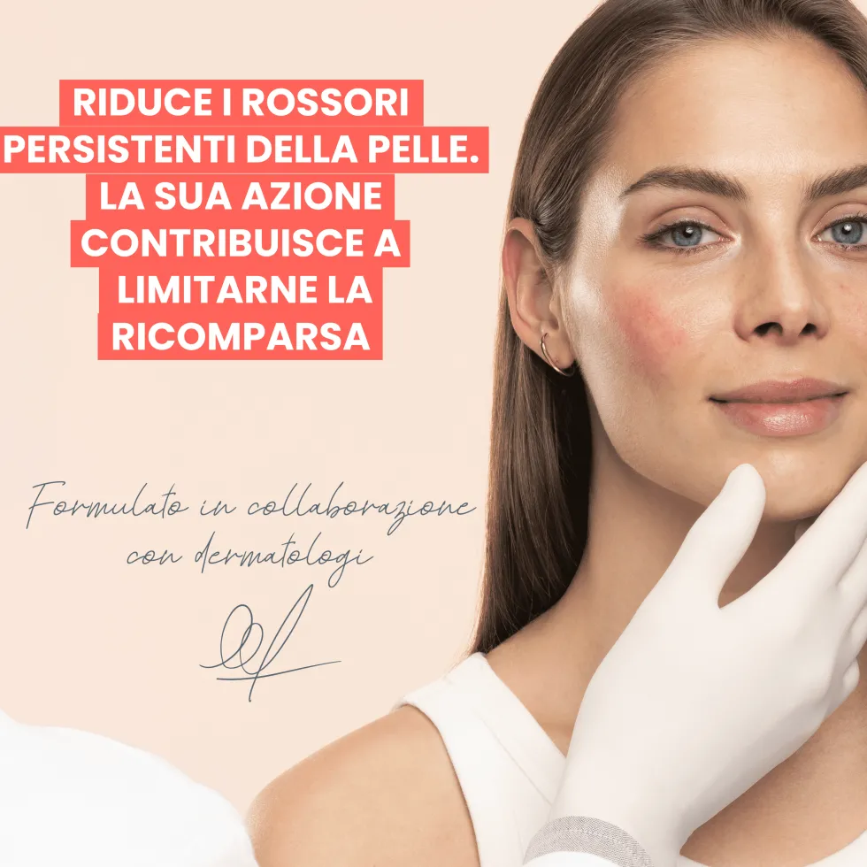 Eau Thermale Avène Antirougeurs - Rosamed Concentrato Rossori Persistenti, 30ml