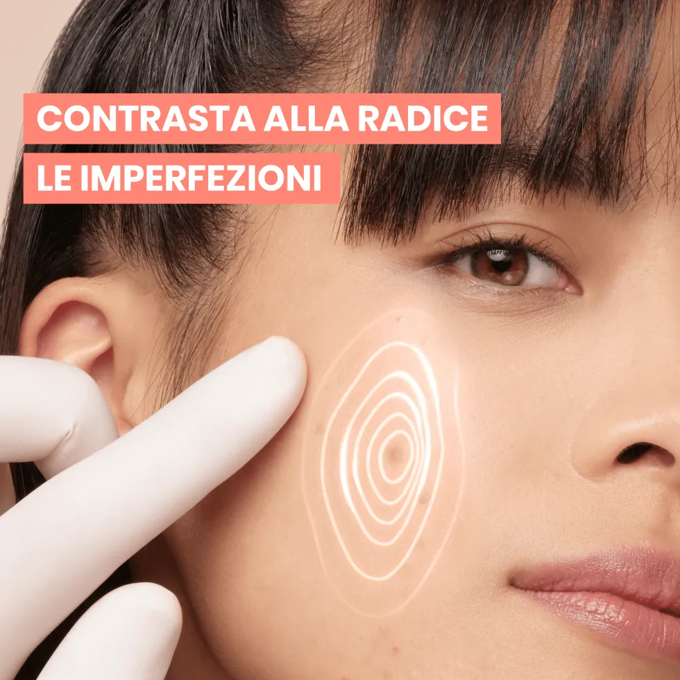 Eau Thermale Avène Cleanance - Comedomed+ Trattamento Intensivo Quotidiano Anti-Imperfezioni, 30ml