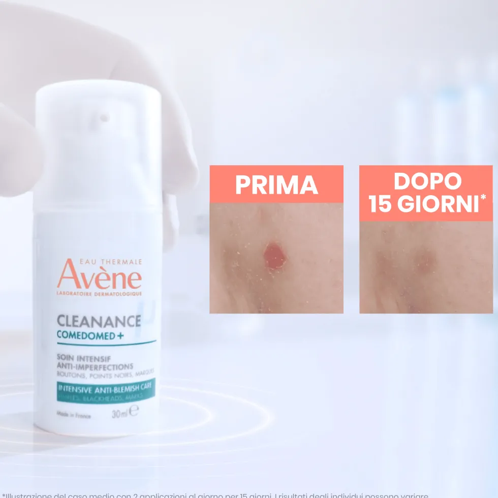 Eau Thermale Avène Cleanance - Comedomed+ Trattamento Intensivo Quotidiano Anti-Imperfezioni, 30ml