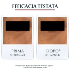Eucerin Anti-Pigment Contorno Occhi - Crema illuminante per ridurre le occhiaie, 15 ml