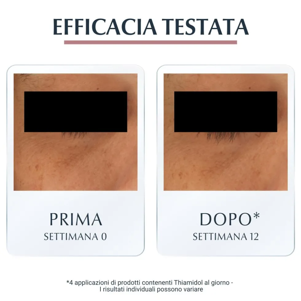 Eucerin Anti-Pigment Contorno Occhi - Crema illuminante per ridurre le occhiaie, 15 ml