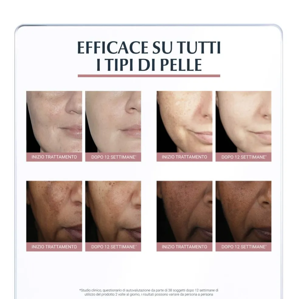 Eucerin Anti-Pigment - Correttore viso anti-macchie per ridurre l'iperpigmentazione, 5 ml