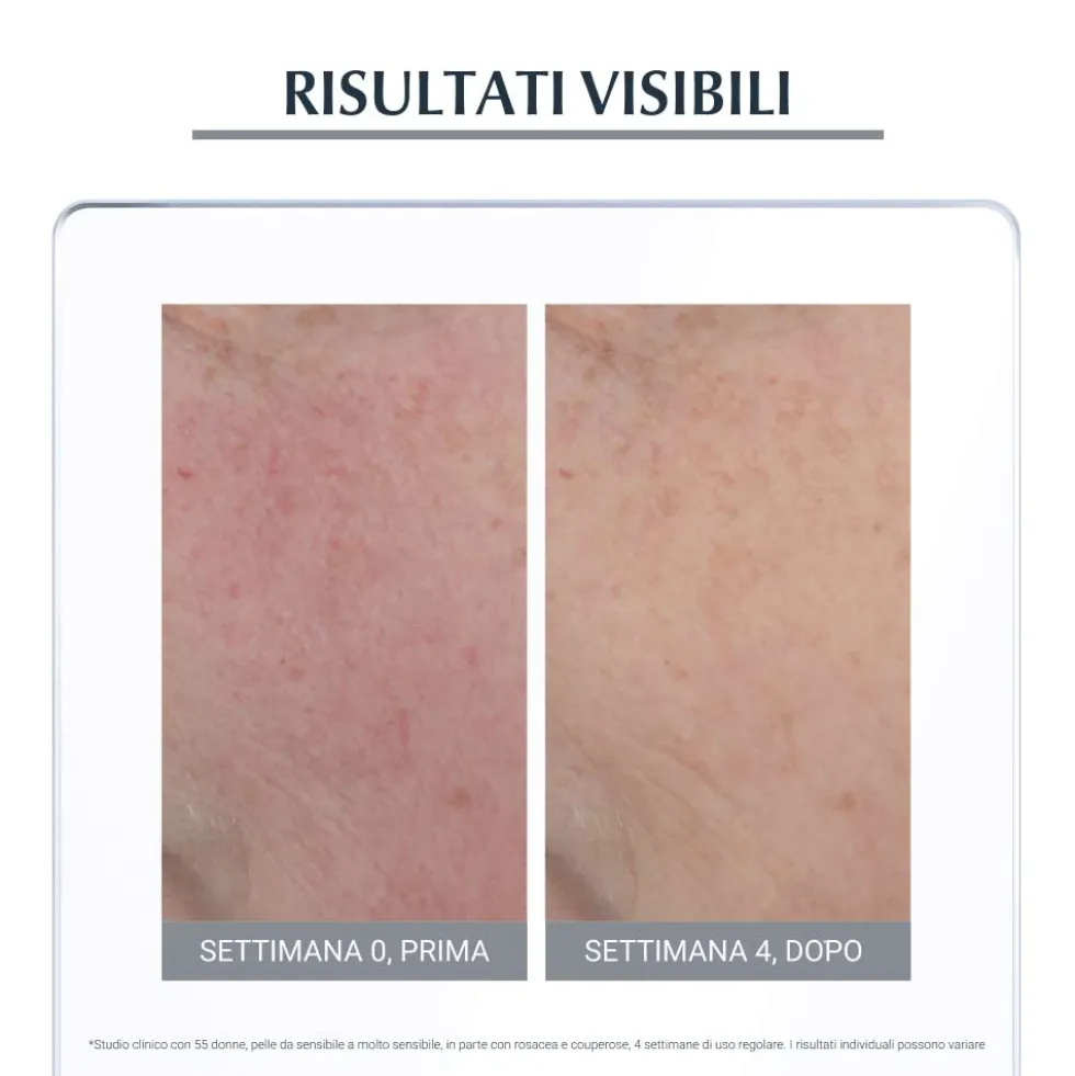 Eucerin Anti-Rose - Trattamento notte lenitivo per la pelle sensibile e arrossata, 50 ml
