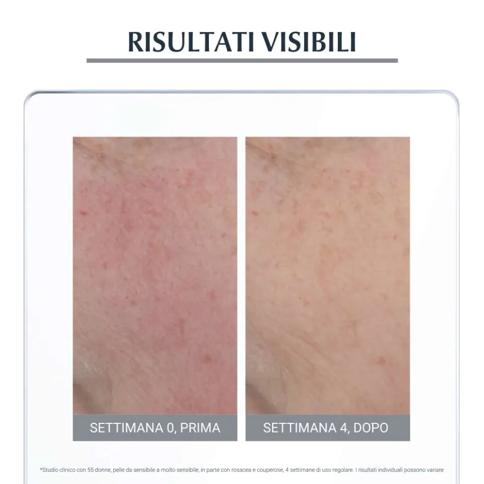 Eucerin Anti-Rose Trattamento Giorno SPF25 - Crema viso per lenire i rossori e la couperose, 50 ml