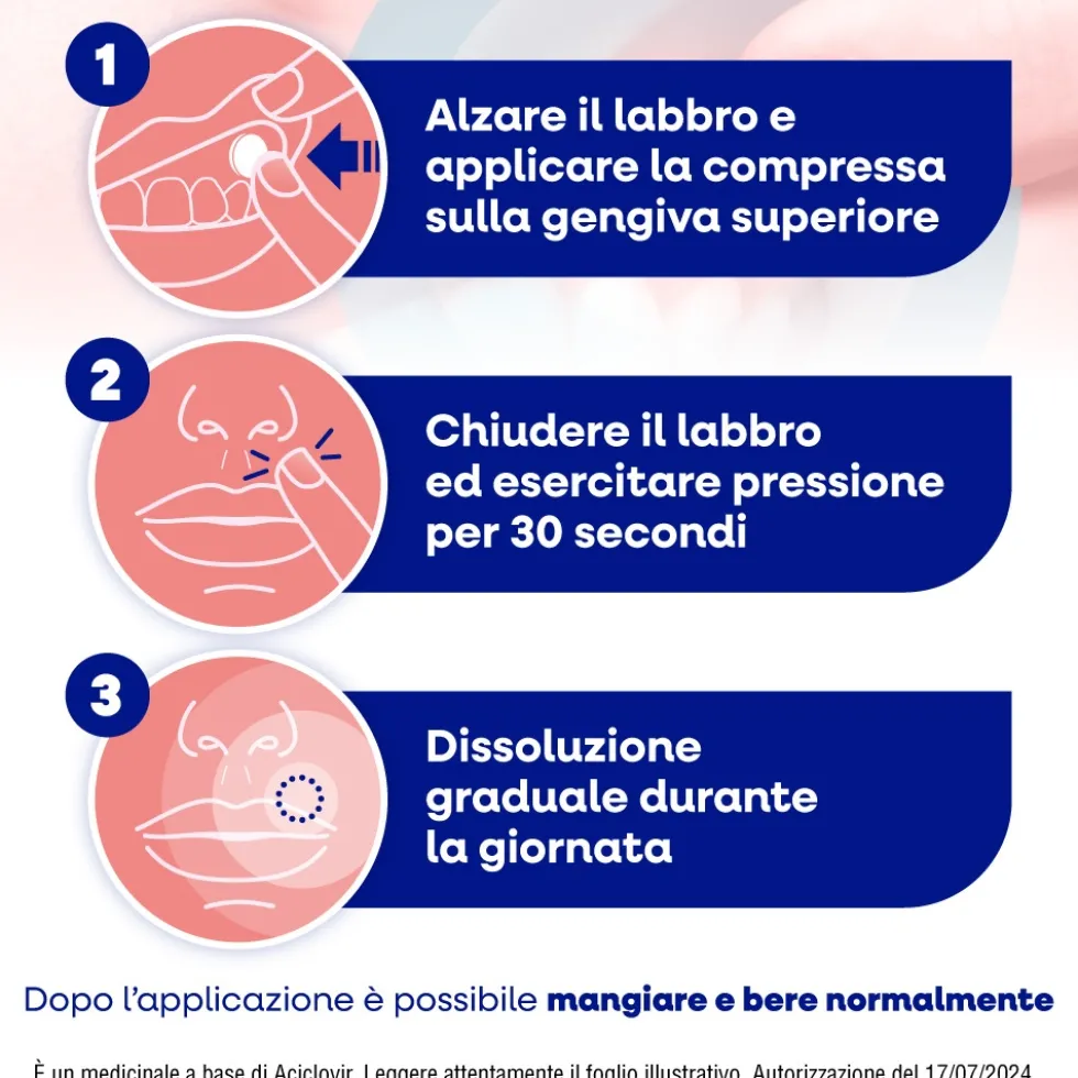 Menarini Herpmed Labiale Compresse Buccali Mucoadesive Aciclovir 50mg, 2 Compresse