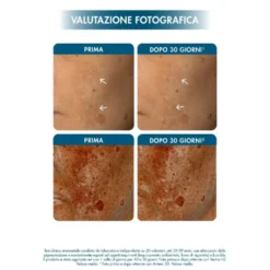 Miamo Superdose Vit C + [C,L] Radiance Activator Freeze Dry Serum Siero Antiossidante Antiglicante Anti-Inquinamento, 10 Giorni di Trattamento