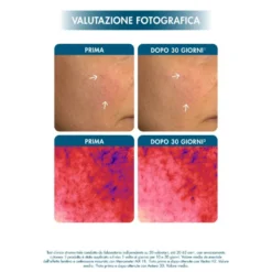 Miamo Superdose Vit C + [C,L] Radiance Activator Freeze Dry Serum Siero Antiossidante Antiglicante Anti-Inquinamento, 10 Giorni di Trattamento