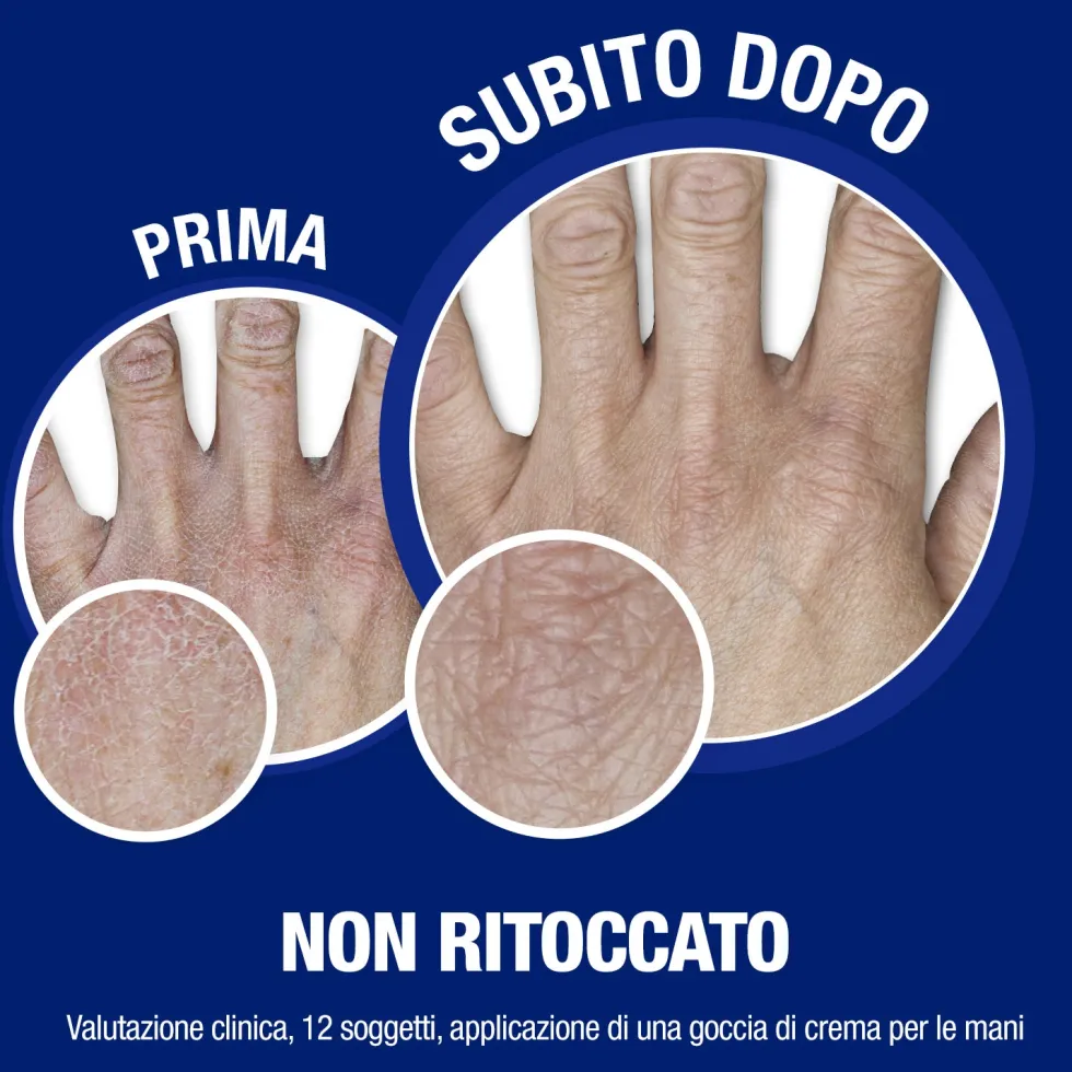 Neutrogena Formula Norvegese - Crema mani e unghie idratante per la pelle screpolata, tubo da 75 ml