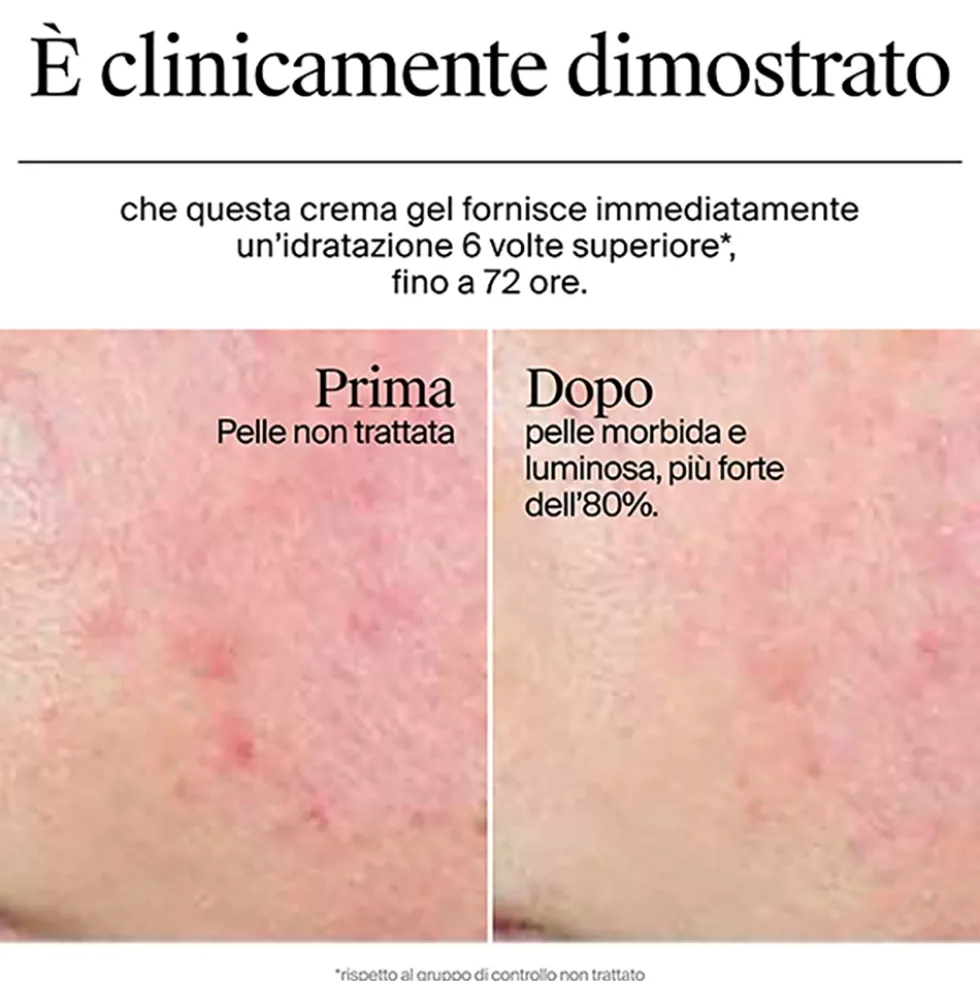 Neutrogena Hydro Boost Crema Gel - Crema idratante per il viso con acido ialuronico, 50 ml