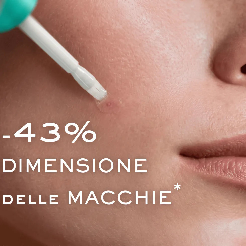 Nuxe Zinc Power Correttore imperfezioni allo zinco Gel antiacne e seboregolatore per il viso, 10 ml
