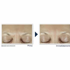RoC Derm Correxion - Fill + Treat Siero Viso Retinolo e Acido Ialuronico, 15ml