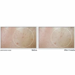 RoC Multi Correxion - Even Tone + Lift Idratante Viso con SPF30, 50ml