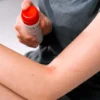 SVR Cicavit+ - Spray lenitivo anti-prurito e anti-segni per la pelle sensibile, 40 ml