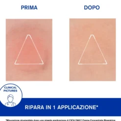 Uriage Cica-Daily Crema Concentrata Riparatrice, 50ml